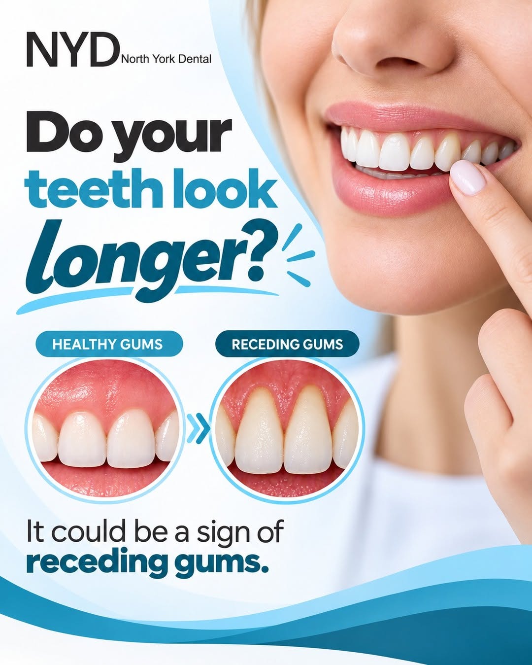 North York Dental Instagram post: Do your teeth look longer? It could be a sign of receding gums