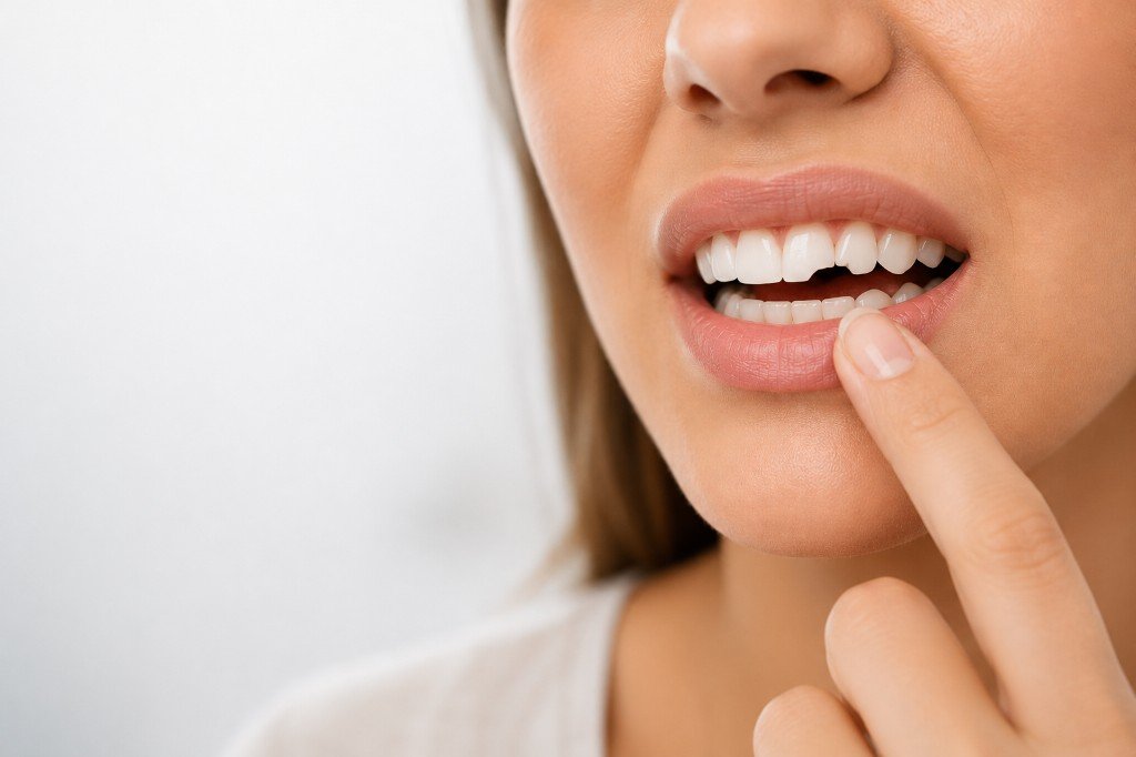 Broken or Chipped Tooth at North York Dental