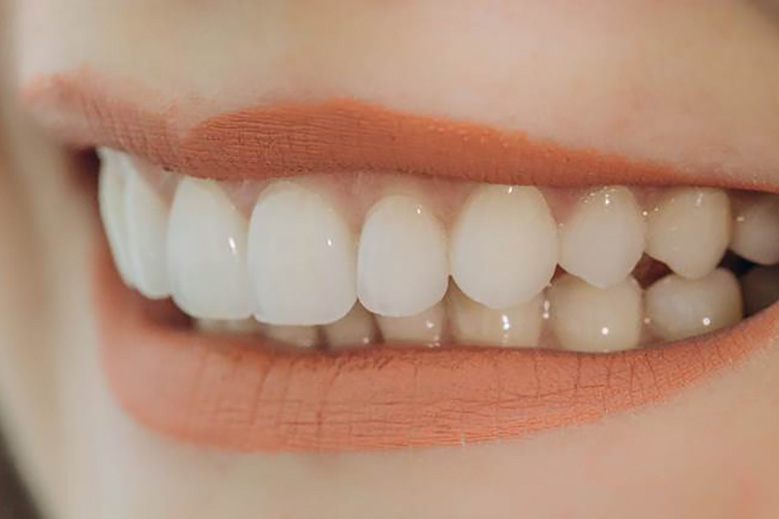 Closeup of healthy smile with tooth-coloured fillings in North York