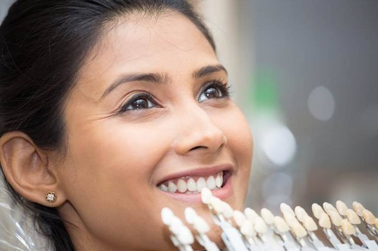 Patient getting veneers in North York